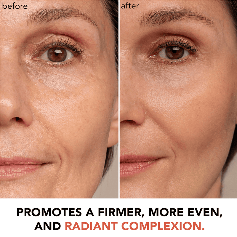 Before and after comparison of a woman's face with text promoting skin improvement.