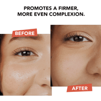 Before and after comparison of a woman's eye area with text promoting skin firmness.