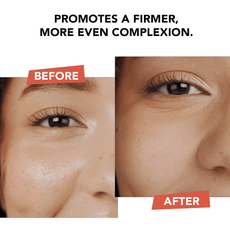 Before and after comparison of a woman's eye area with text promoting skin firmness.