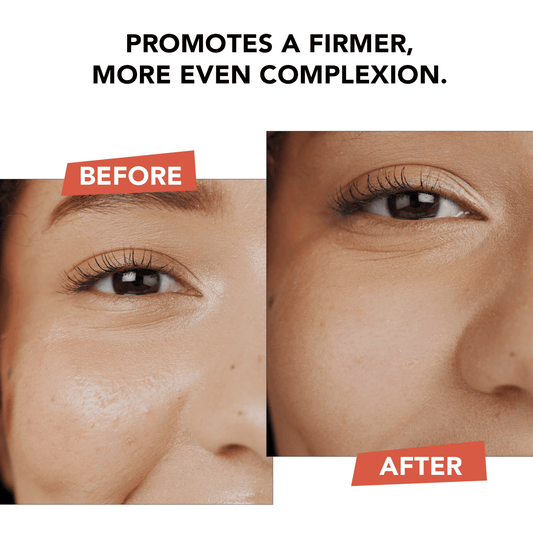 Before and after comparison of a woman's eye area with text promoting skin firmness.